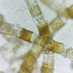 Oedogonium. Foto realizada por Carlos Martínez Sanz.