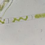 Spirogyra. . Foto realizada por Carlos Martínez Sanz.