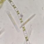 Zygnema. Foto realizada por Carlos Martínez Sanz.